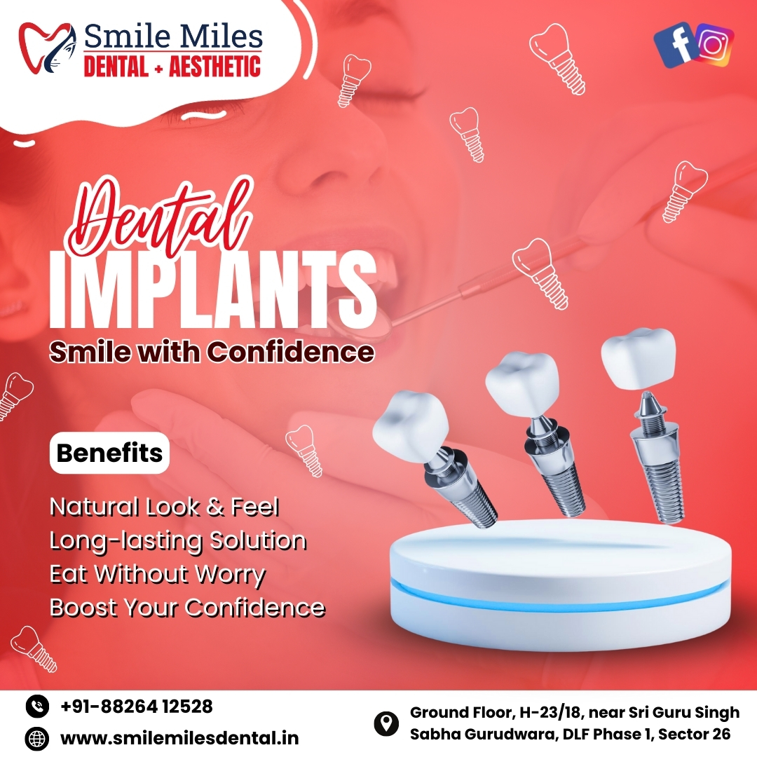Dental Implants Treatment